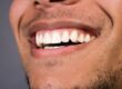 periodontal surgery in Wichita