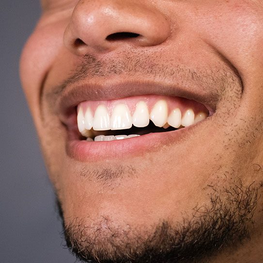 periodontal surgery in Wichita