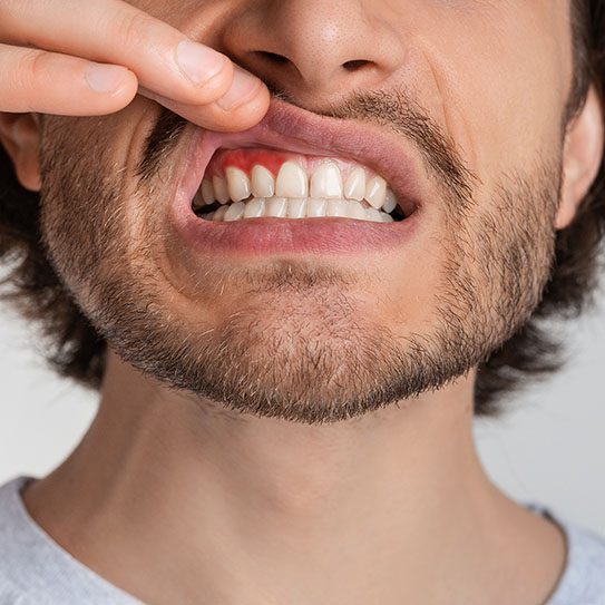gum disease

